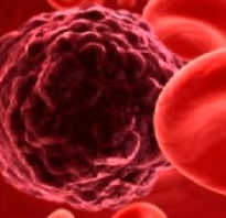 Чем и как лечить заболевание рака крови. Подробное описание всех первых признаков рака крови