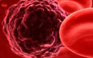 Чем и как лечить заболевание рака крови. Подробное описание всех первых признаков рака крови