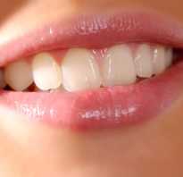 Видеть во сне вставные зубы. К чему снится вставные зубы? К чему снятся зубы