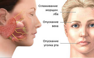 Народное средство от неврита лицевого нерва. Как и чем лечить воспаление лицевого нерва? Осложнения неврита лицевого нерваОписание][