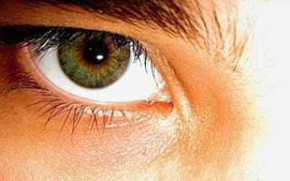 Цвет глаз зеленый и голубой. Зелено-карие глаза