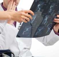 Интраоперационная холангиография. Холангиография при МРТ — особенности проведения процедуры. Какие заболевания могут быть диагностированы