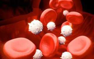 Могут ли быть лейкоциты. Повышенные лейкоциты в крови у женщин. Причины повышения белых клеток