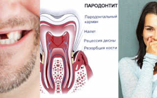 Почему формируется неправильный прикус и как его исправить? Неправильный прикус зубов — причины и последствия Стирание зубов при неправильном прикусе