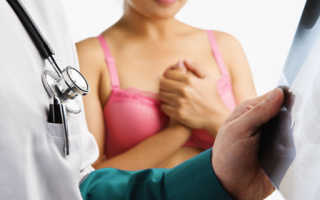 Рак молочной железы что делать как лечить. Лечение рака груди. Рак груди – лечение онкологии в домашних условиях