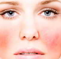 Аллергическая сыпь на лице у взрослого причины. Аллергия на лице – причины появления и лечение недуга. Примеры препаратов приведены ниже