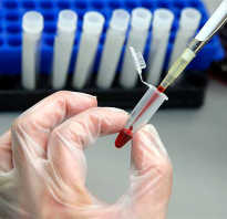 Тест на цитомегаловирус пройден и в крови IgG антитела обнаружены! Что это значит для вашего здоровья? Норма для IgM. Факторы влияния Наличие iggОписание][