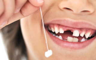 При прорезывании постоянных зубов вначале появляются. Коренные зубы у детей: порядок прорезывания. Когда появляются постоянные коренные зубы