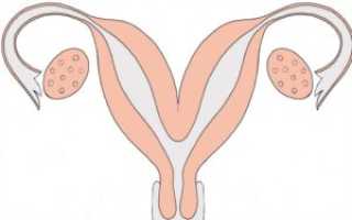 Анатомо-функциональная несостоятельность матки как причина невынашивания беременности. Что такое рогатая матка и причины её образования Однорогая матка что делать если забеременела
