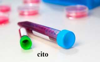 Анализ CITO (крови, мочи и др.): Определение, Показания, Виды, Сроки, Цена, Сдача. Что означает cito на направлении на анализ крови Cito лаборатория